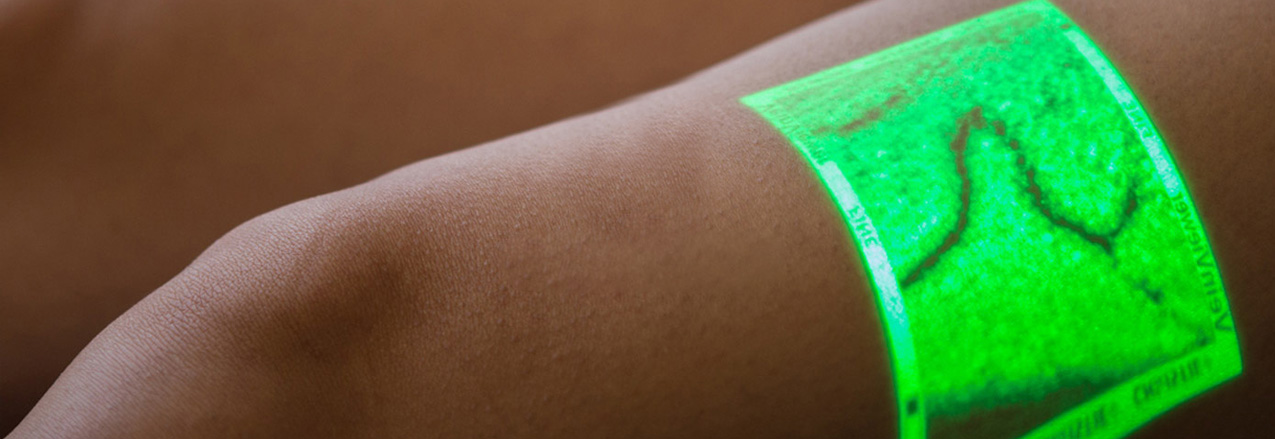  Realidade Aumentada (VeinViewer)